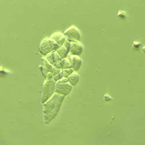 Fotografie MAGUS HCM360 Gerät zur Arbeit mit dem Hoffmanschen Modulationskontrast, mit Objektivsatz,  14