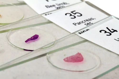 Foto Levenhuk N80 NG Objektträger-Set „Um alles zu sehen!“,  17