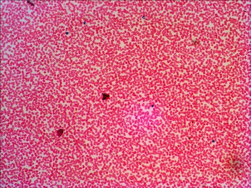 Bild Levenhuk N38 NG Objektträger-Set mit vorbereiteten Proben,  16